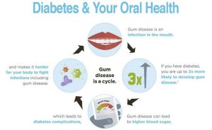 Diabetes And Oral Health Problems