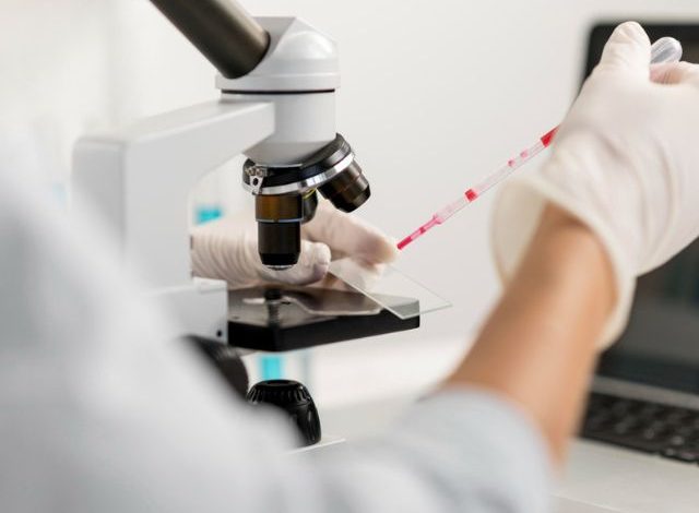 colonoscopy test sample